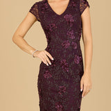 Cap Sleeve Embellished Dress